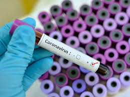 43 new Covid-19 cases reported in Telangana on Saturday