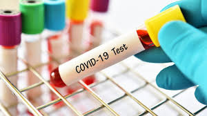 6,987 samples tested for Covid19 in Nagaland