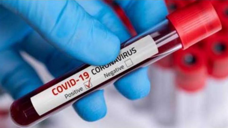 2 more test COVID19 positive in Meghalaya