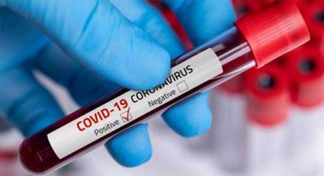 2 more test COVID19 positive in Meghalaya