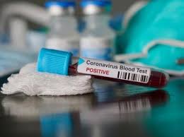 Four under-trials arrested recently test COVID-19 positive